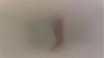 Ее кожа покраснела и покрылась волдырями